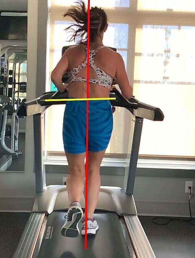 Rear view running gait assessment